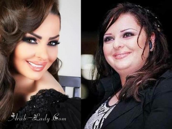 صور فنانات العرب قبل وبعد عمليات التجميل