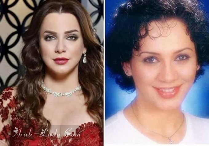 صور فنانات العرب قبل وبعد عمليات التجميل