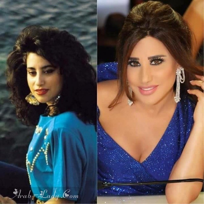 صور فنانات العرب قبل وبعد عمليات التجميل