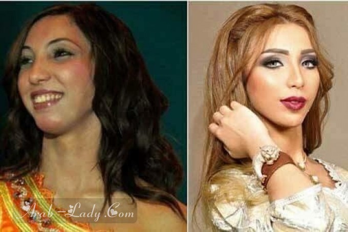 صور فنانات العرب قبل وبعد عمليات التجميل