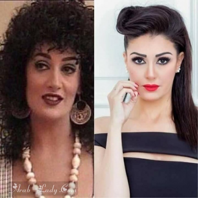 صور فنانات العرب قبل وبعد عمليات التجميل