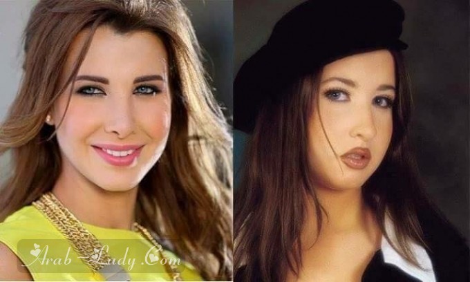 صور فنانات العرب قبل وبعد عمليات التجميل