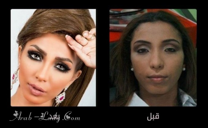 صور فنانات العرب قبل وبعد عمليات التجميل