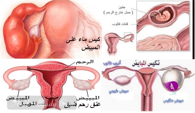 تعرفي على 9 أسباب لتأخر الحمل لدى المرأة