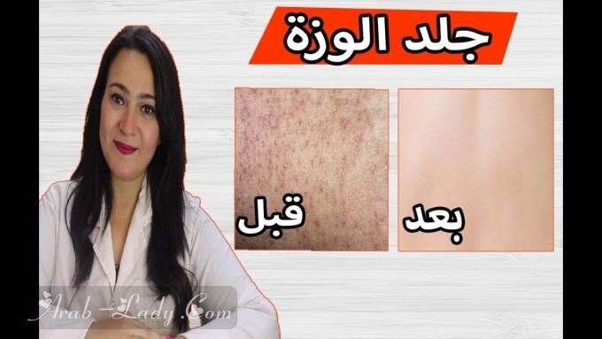 10 طرق للتخلص من جلد الإوزة بسهولة وسرعة