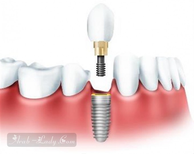 أحدث الابتكارات الطبية لتجميل الأسنان وتلميعها