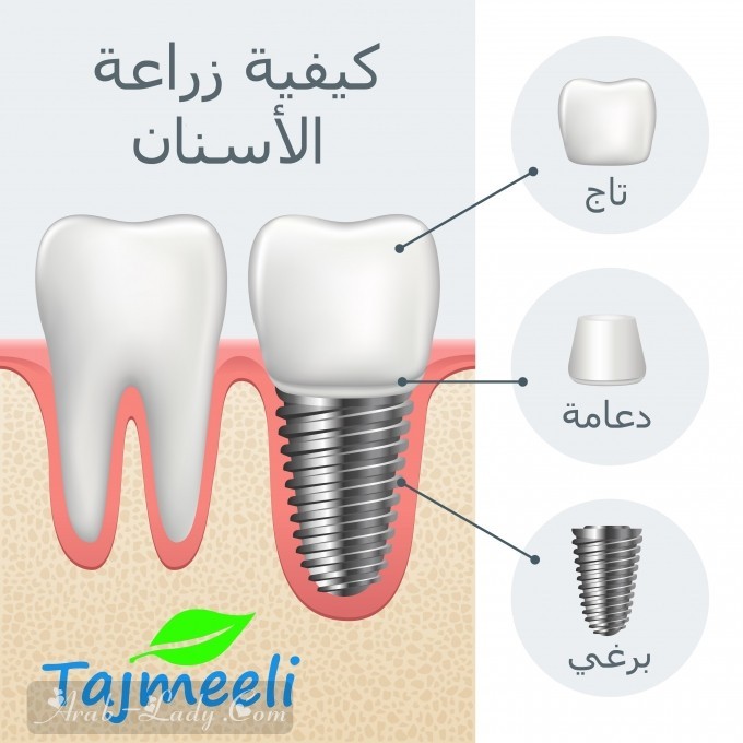 أحدث الابتكارات الطبية لتجميل الأسنان وتلميعها