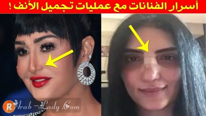 فنانات قبل وبعد عميات التجميل