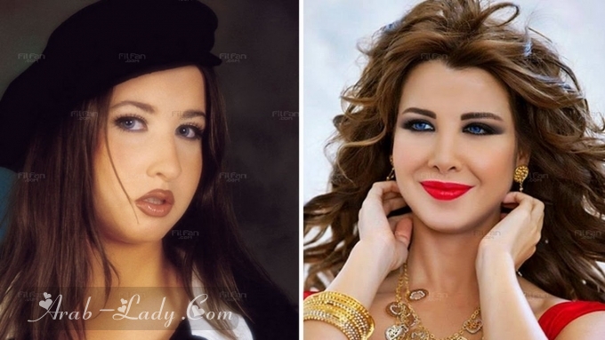 فنانات قبل وبعد عميات التجميل