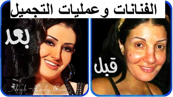 فنانات قبل وبعد عميات التجميل