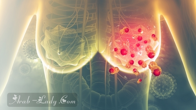 كل ما تريدين معرفته عن سرطان الثدي من الأسباب والأعراض إلى العلاج