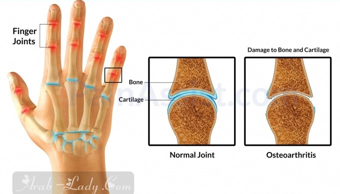 الطرق الصحيحة لمواجهة آثار التهاب المفاصل (الروماتويد) على اليدين