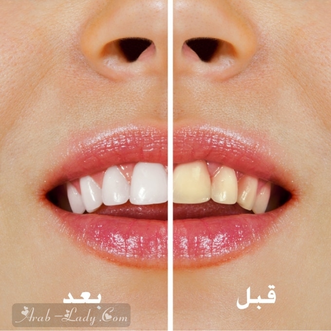 خلطات سحرية لتبييض الأسنان بشكل فوري!!