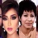 عمليات التجميل التي أدت إلى تغيير صادم في ملامح النجمات