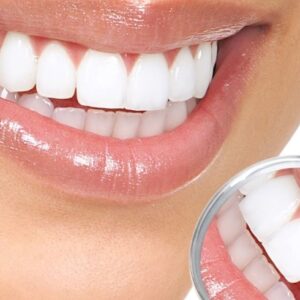 تبييض الأسنان : 6 وصفات طبيعية للحصول على ابتسامة النجمات