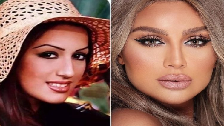 عمليات التجميل التي أدت إلى تغيير صادم في ملامح النجمات