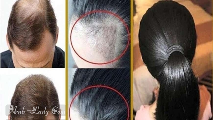 الوصفة الهندية المعجزة في تقوية الشعر وزيادة كثافته في مدة قصيرة