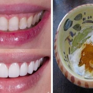 وصفة الثلاث دقائق لأسنان لامعة وناصعة البياض من أول مرة