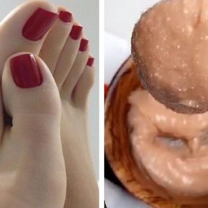 تبييض الرجلين والقضاء على خشونتهما بسر طبيعي متوفر في كل بيت