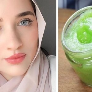 الحل المدمر للكلف والتصبغات بشكل نهائي جربيه ولن تندمي عليه